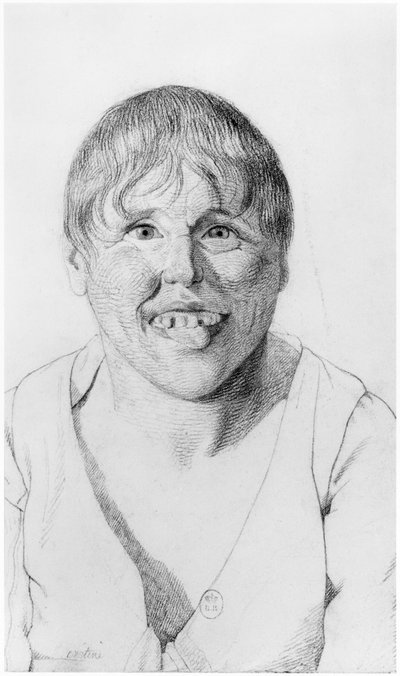 Cretin, Front View, Illustration from an Unpublished Treatise by Jean Etienne Dominique Esquirol on the Lunatics of the Salpetriere Asylum, c.1818 by Georges Francois Gabriel